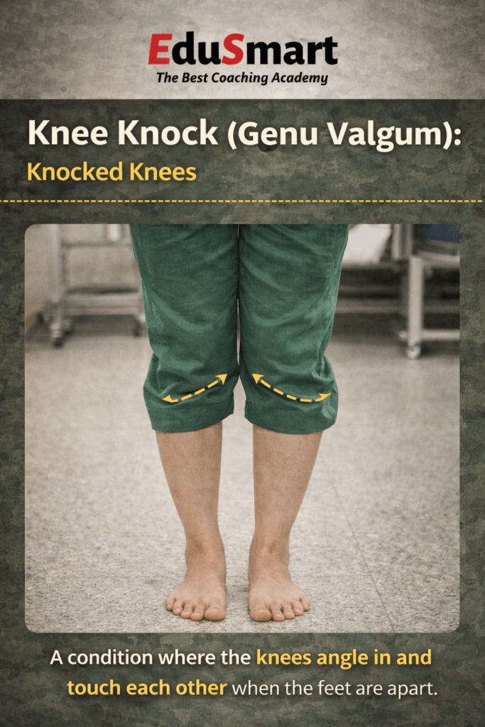 AFNS KNEE KNOCKING CHECK