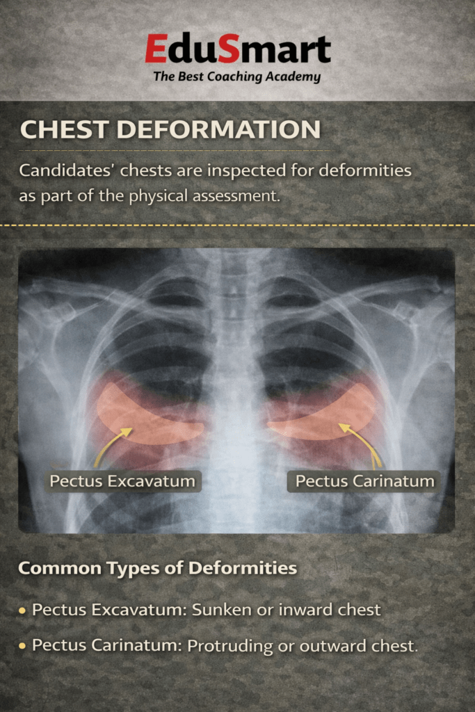 AFNS CHEST DEFORMATION